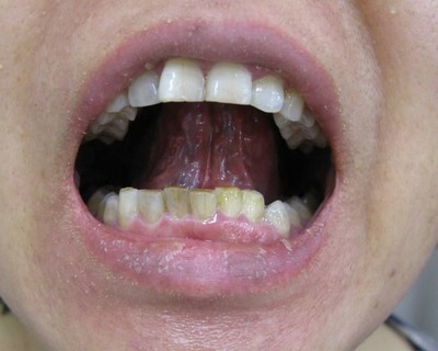 ��������΢