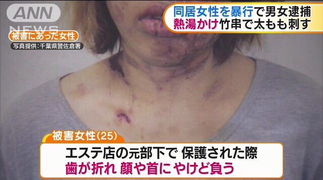 衝撃 オバｑ といわれた２５歳女性 壮絶な暴行の実態 まとめるねん