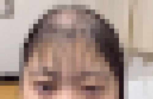 【動画】薄毛女子さん、ポジティブ過ぎてかわいいｗｗｗｗｗ