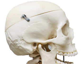 【朗報】女の子さん、整形ガチャでSSRに生まれ変わるｗｗｗ