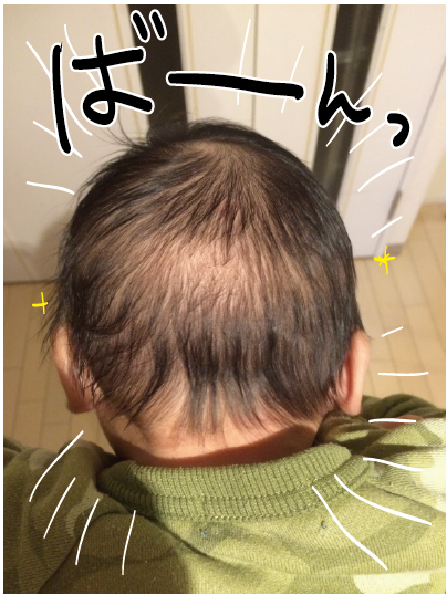 だいごろうとこごろうの１日　ハゲ