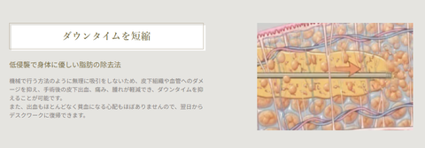 SnapCrab_NoName_2025-7-9_2-52-58_No-00