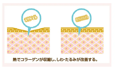 SnapCrab_NoName_2025-4-9_8-55-18_No-00