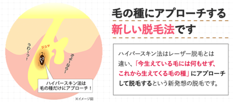 SnapCrab_NoName_2021-4-16_11-57-45_No-00