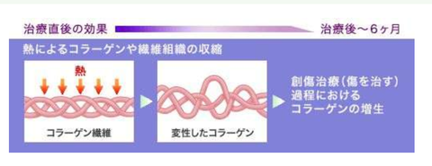 SnapCrab_NoName_2021-6-22_16-35-33_No-00