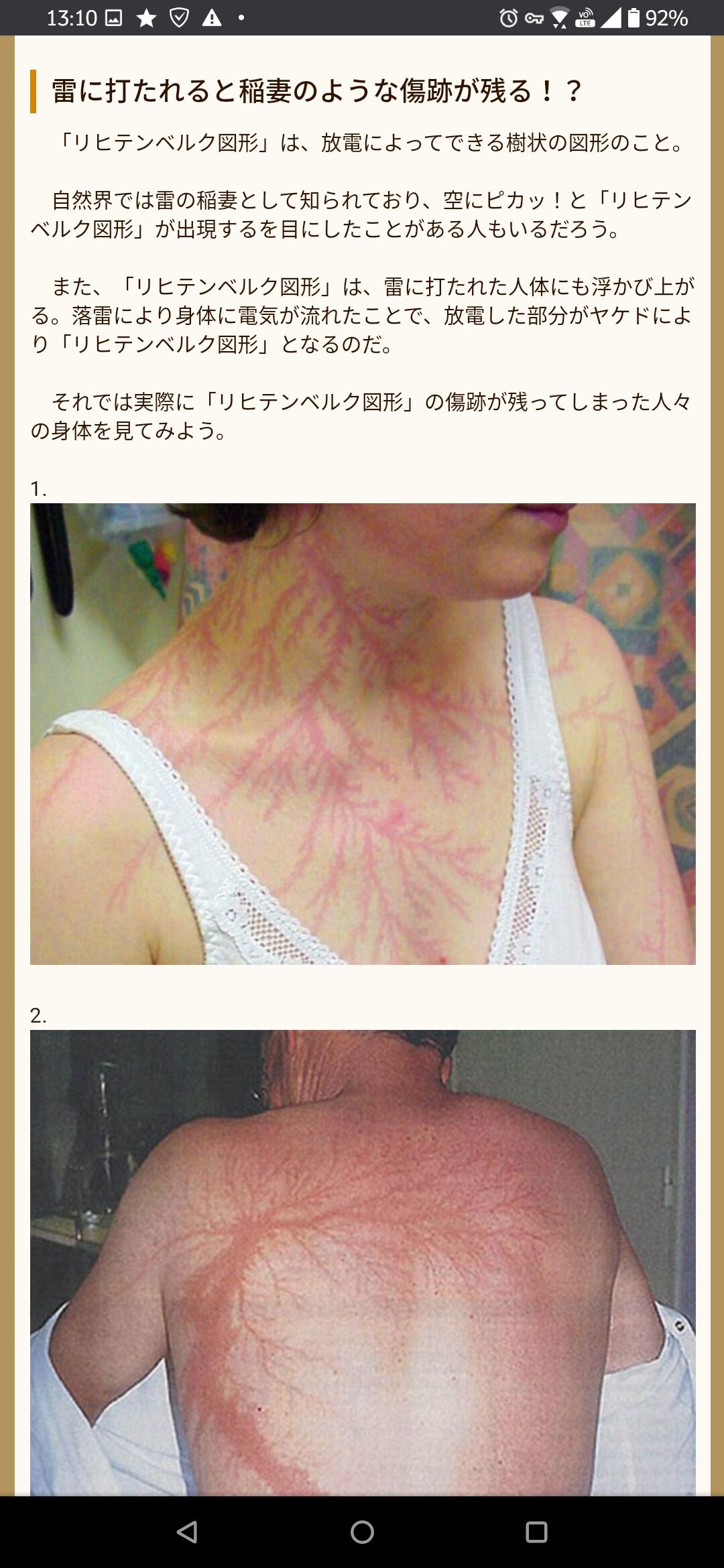 画像 雷に撃たれた結果www おかしなちゃんねる 画像 雷に撃たれた結果www おかしなちゃんねる