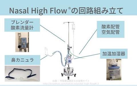 ネーザルハイフロー療法（高流量鼻カニュラ酸素療法）aa