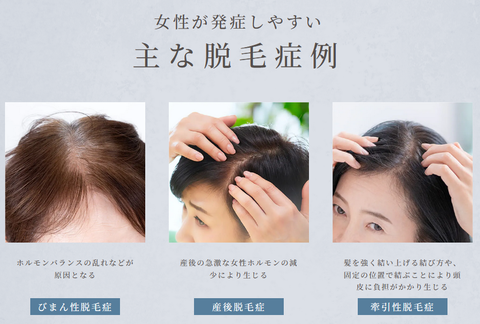 SnapCrab_NoName_2026-4-26_17-45-49_No-00