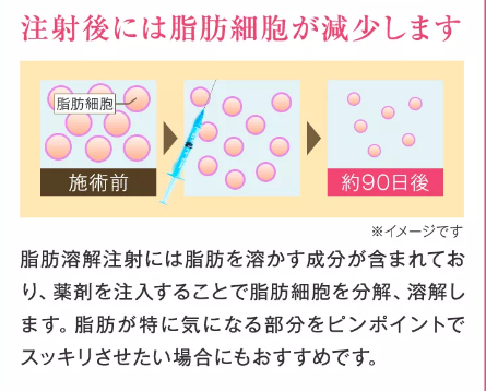 SnapCrab_NoName_2024-2-15_2-47-39_No-00