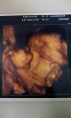 30週 4dエコー My Sweet Home