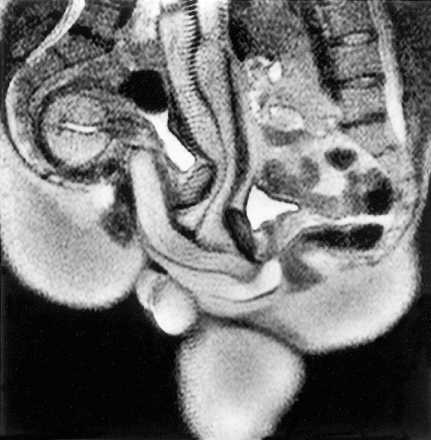 03_m (1)