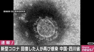 ダウンロード - 2020-02-23T032553.478