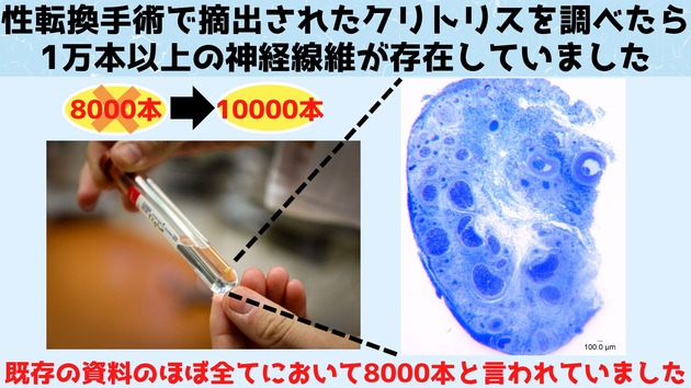 8adc3913989a0e5488eef2274506f41e