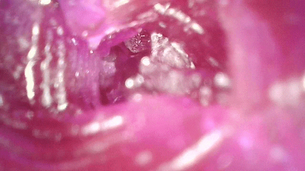 hanjukusakyuimouto2001