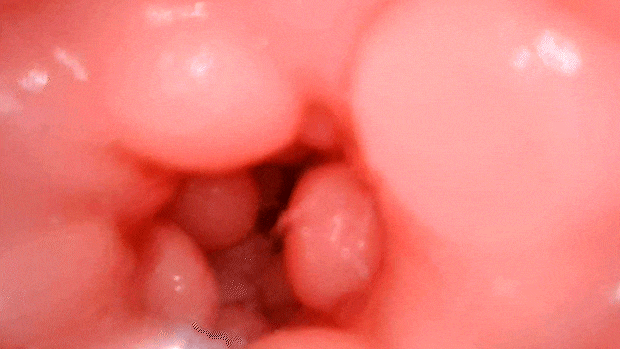 coricoriring003