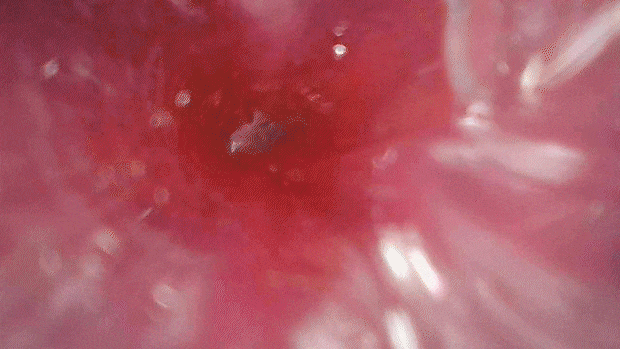 zorionaho003