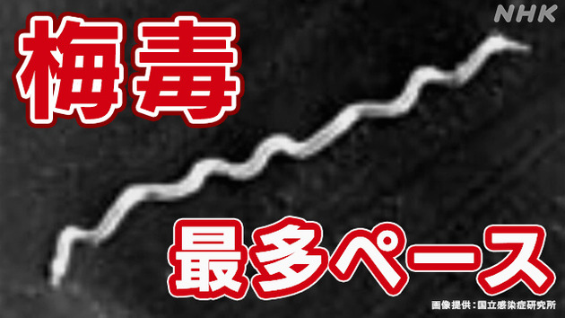 K10014264531_2311211746_1121174808_01_02