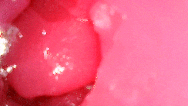 motiyukiberiburatubo003