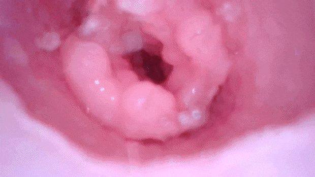 fuwapomukikimora003
