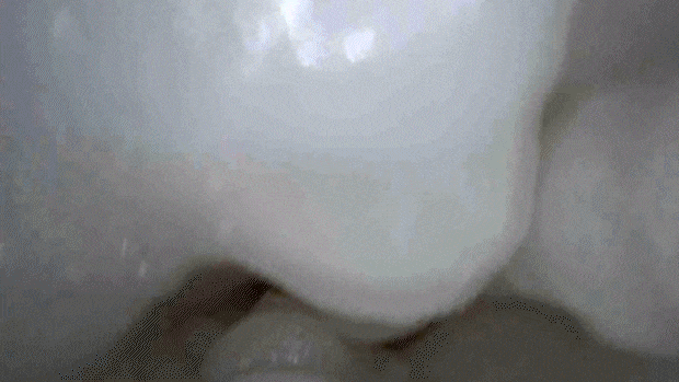 twinbreak002