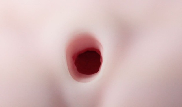 003