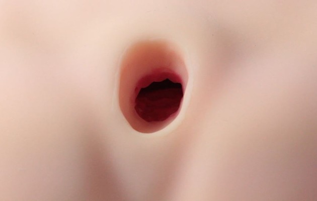 003