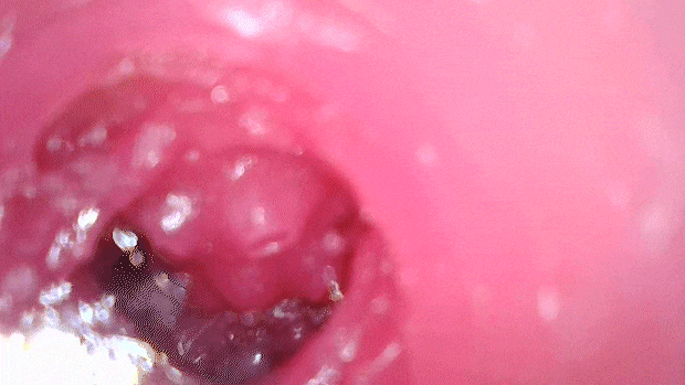 haitpokuanbient003