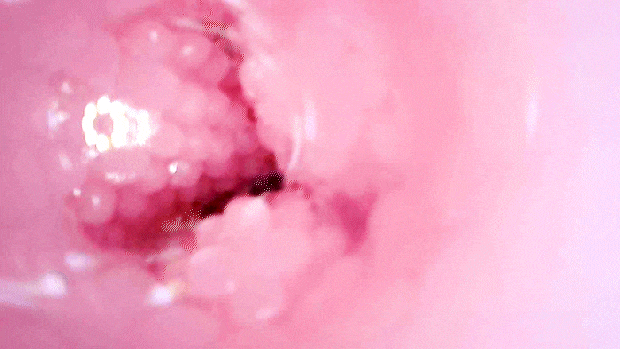 pittirispiralhard003