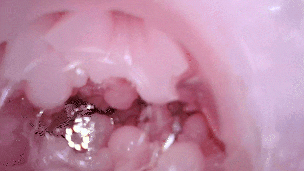 tyoudosukebebakunyu003