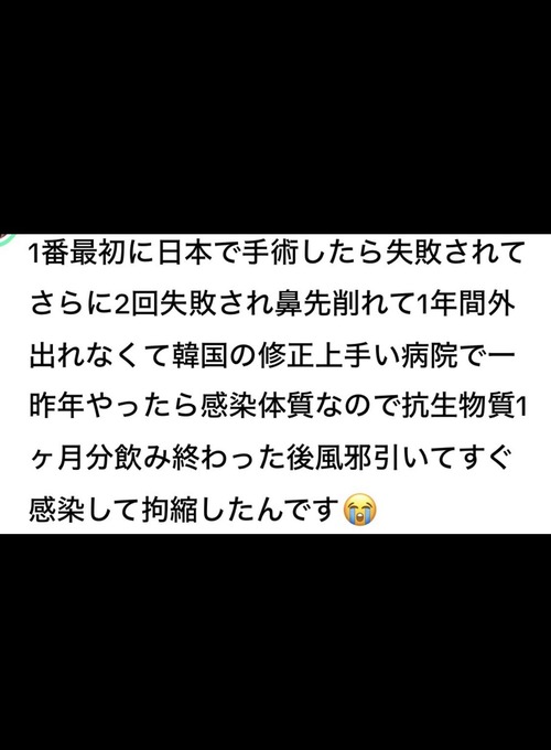 【悲報】鼻整形の「拘縮」、ガチでヤバすぎるｗｗｗｗ