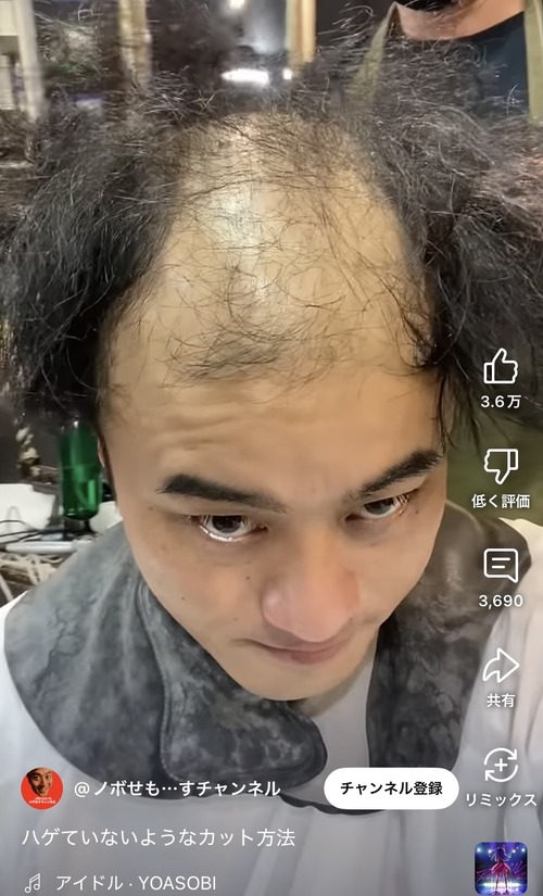 【画像】カリスマ美容師、ハゲを救済する。ここまで変わるのかｗｗｗｗｗ