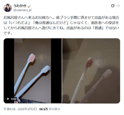 【悲報】夜職嬢、客が使った歯ブラシが血塗れで咽び泣くｗｗｗｗ