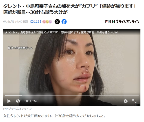 【悲報】女性タレント、犬に噛まれ30針縫う大けがを負い「傷だらけの顔」を投稿する…