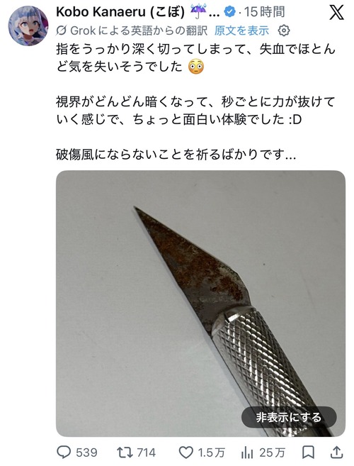 【悲報】人気VTuber、ちょっとヤバそうな怪我をする。おまえらの想像の1.3倍ヤバそうｗｗｗｗ