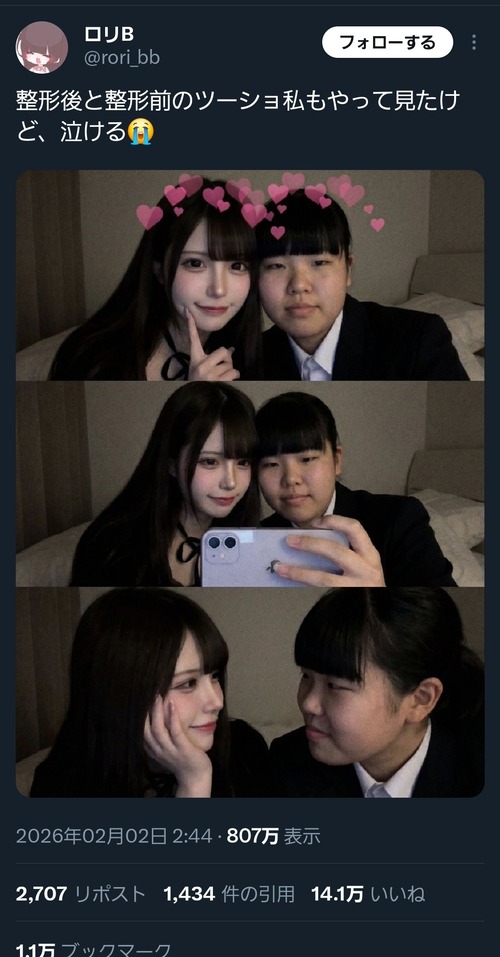 【画像】女の子「整形後と整形前のツーショやってみたけど、泣ける(ﾊﾟｼｬｯ」→21万ｲｲﾈｗｗｗｗ