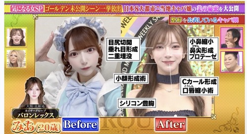 【画像】キャバ嬢、整形しまくってめちゃくちゃ美人になるｗｗｗｗ