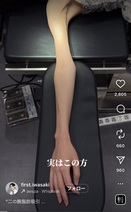 【画像】日本人女性の「ガリガリ至上主義」、さらに限界突破へｗｗｗｗ