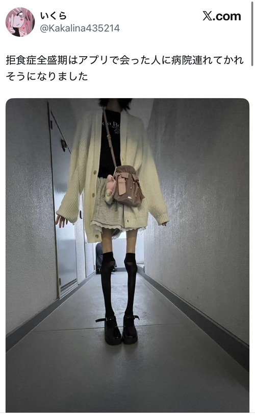 【画像】ヒョロガリ系女子、拒食症全盛期の時の写真を公開するｗｗｗｗ