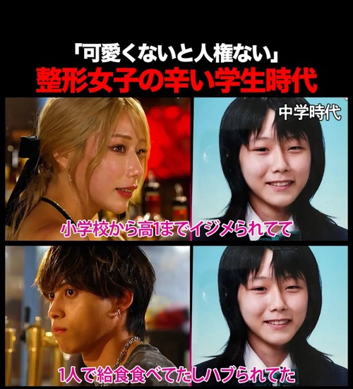【画像】整形女子、悲惨だった学生時代の姿を晒すｗｗｗｗ