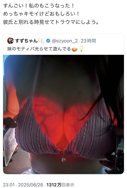 【画像】豊胸した胸、不気味に光るｗｗｗｗ