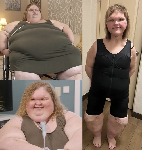 【画像】ぽっちゃり女子、仰天チェンジして別人みたいになるｗｗｗｗ