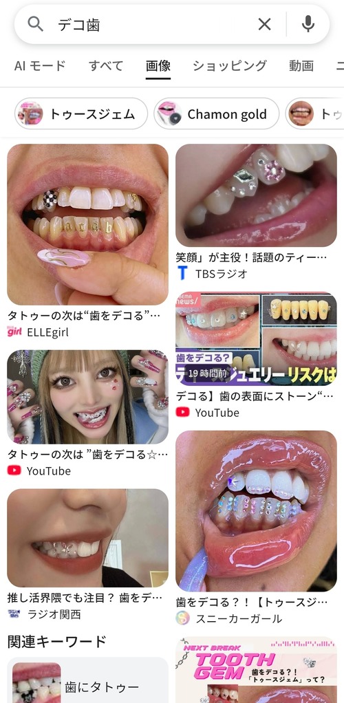 【画像】歯をデコるブーム到来。これ半分食べカスだろｗｗｗｗ