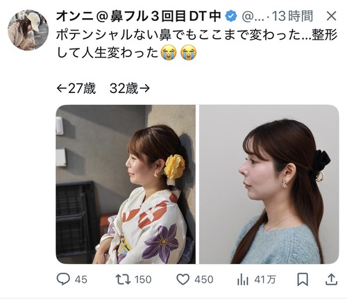 【朗報】女の子、整形して人生が変わるｗｗｗｗ