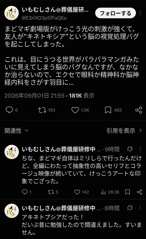 【悲報】映画を見たオタク、「脳の視覚処理バグ」を起こしてしまうｗｗｗｗ