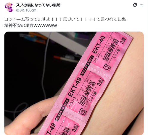 【画像あり】ガルバ店員さん、膝裏を写す→避妊具が写ってると指摘→実際はこれでしたｗｗｗｗ