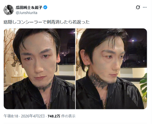 【画像】アウトローのカリスマ「顔面タトゥー消してみたｗ」→結果ｗｗｗｗ