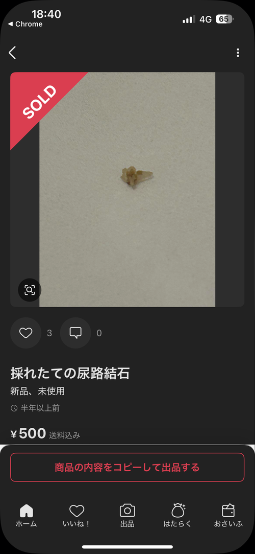 【画像】メルカリで「尿路結石(新品、未使用)」売ってて草ｗｗｗｗ