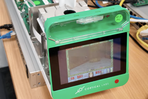 【衝撃映像】シャーレの上で培養された「人間の脳細胞」がゲームをしている映像がこちら。果たしてこの脳に「意識」は存在するのか？