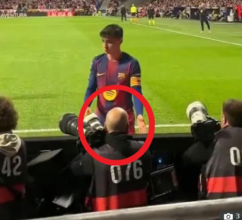 【悲報】ハゲ、ガチでサッカーボールと間違えられてしまうｗｗｗｗ