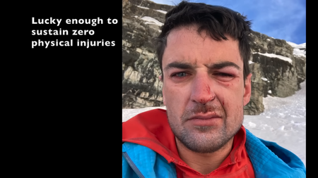 GoPro Footage from Matt’s Fall in Ep 88 1-32 screenshot